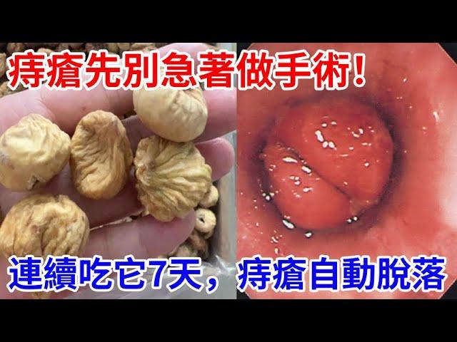 痔瘡先別急著做手術！連續吃它7天，痔瘡竟自動脫落！連醫生都不敢相信！