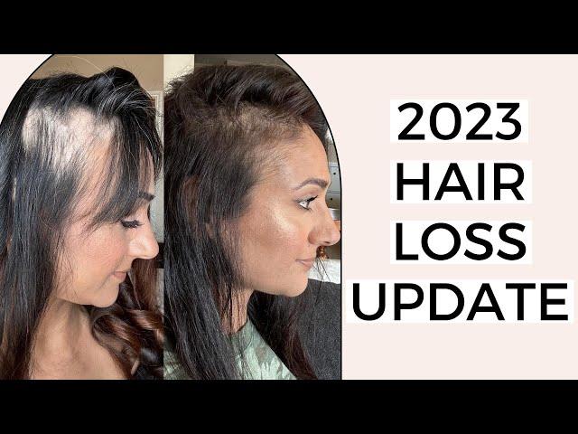 2023 Hair Loss Update | Deepa Berar