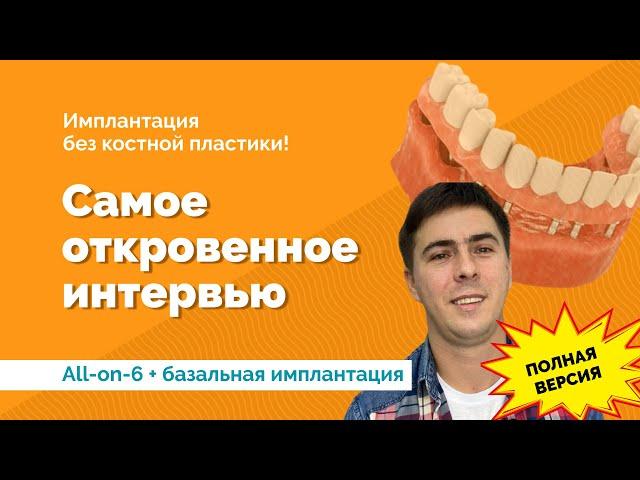 Все на 6 и базальная имплантация. Отзыв пациента подробный