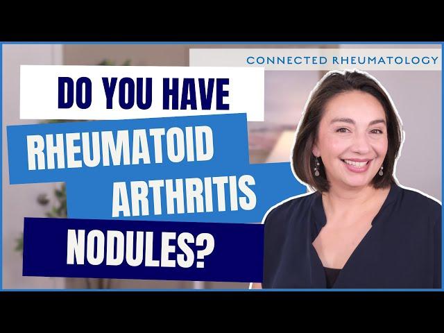 Surprise cause of Rheumatoid Arthritis nodules and everything else you need to know