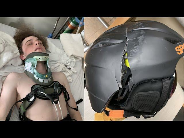 Helmet saves 19-year-old skier's life after smashing into tree, family says