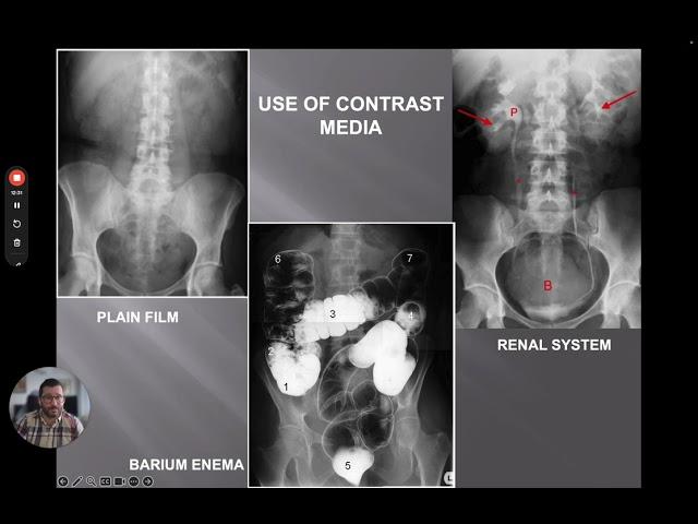 Introduction to Chest X ray 🩺 Part 1 of 4