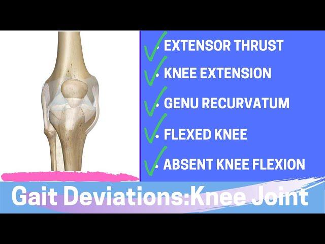 Gait Deviations: Knee Joint Complex Secondary to Knee Joint Dysfunction