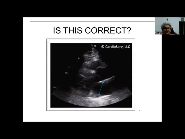 46th Basic Course of Echo, 16-10-22 Measurements-1