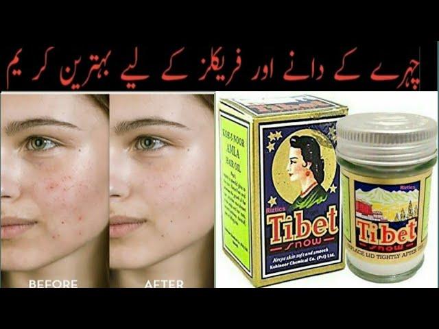 How To Use Tibet Snow Cream. Get White Bright And Spotless Skin. Hindi urdu.