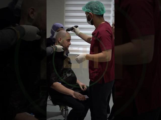 #shortsvideo #shortvideo #hairtransformation #hairtransplantationsurgery #hairstyle