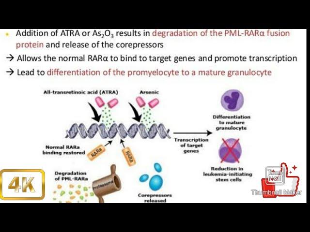 Differentiation Syndrome pathophysiology