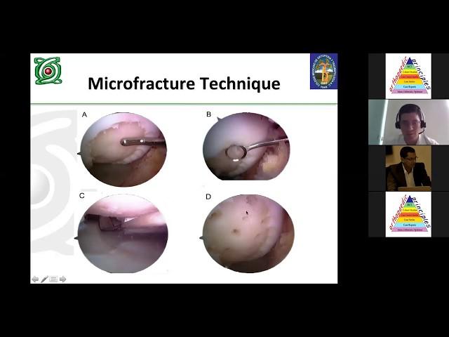 Matrix Encapsulated Autologous Chondrocyte Implantation