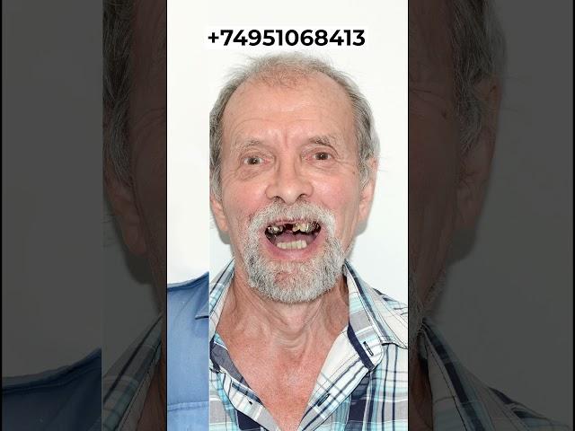 Идеальная улыбка всего за 3 дня = 339 000 руб! #клиника #dentist  #estetus #доктор #beforeandafter