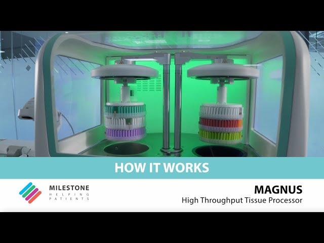 MAGNUS High Throughput Tissue Processor – How it works