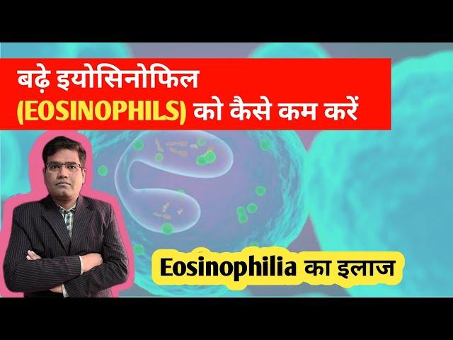 Eosinophilia का इलाज | Treatment of High Eosinophil in Blood..