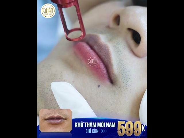 Cận Cảnh Quá Trình Khử Thâm Môi Nam tại CiHan