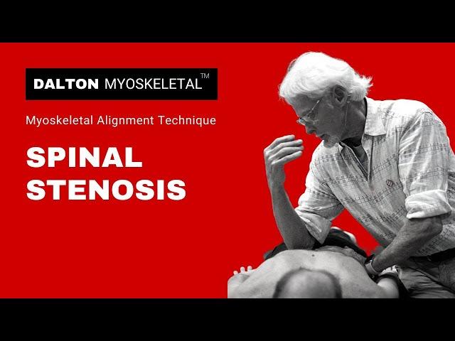 Understanding Bilateral Sciatica & Lumbar Stenosis: Erik Dalton Explains Causes & Treatment Options