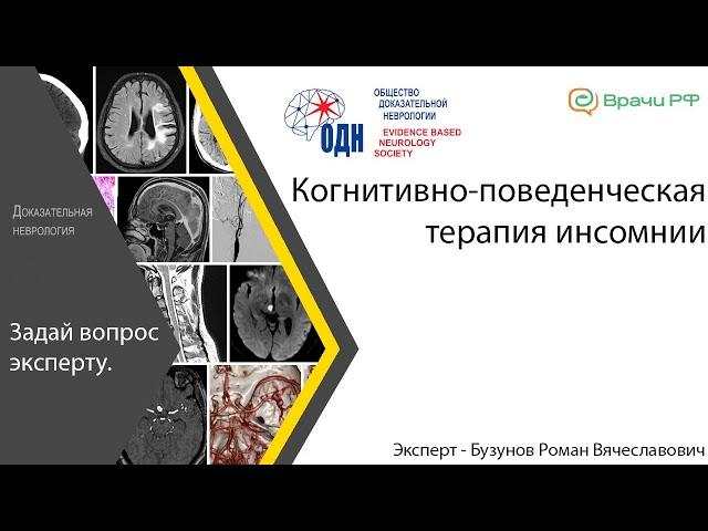 Когнитивно-поведенческая терапия инсомнии