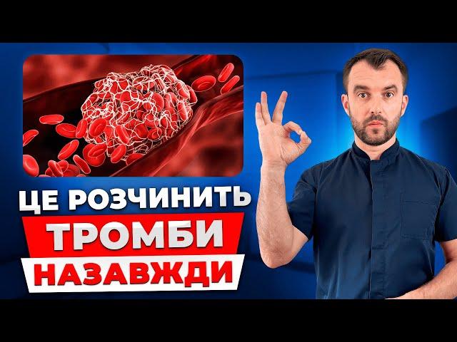 Як врятувати себе від тромбів? Зробіть це і тромби пройдуть назавжди