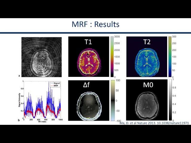 ISMRM MR Academy - MR Fingerprinting