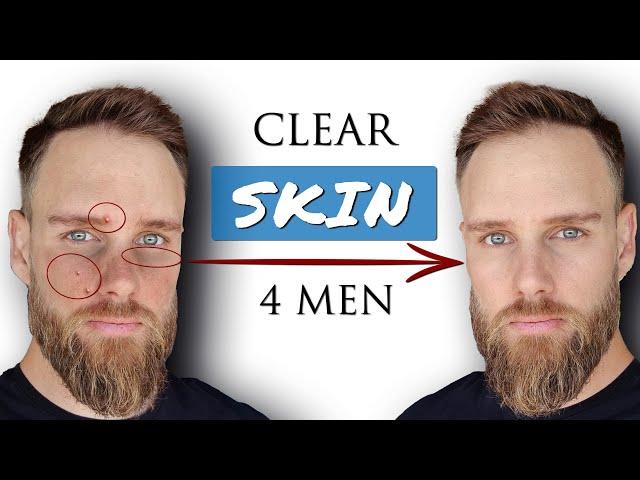 How to GET CLEAR SKIN for MEN || Advanced Skincare Secrets