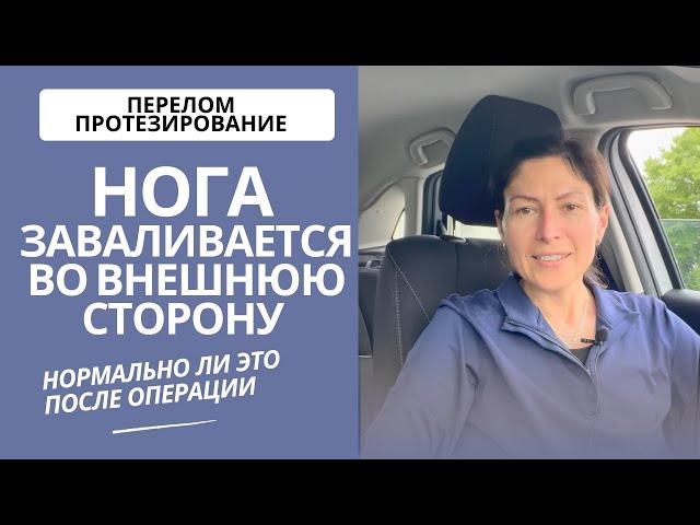 После операции, нога заваливается во внешнюю сторону. Нужно ли что-то делать?