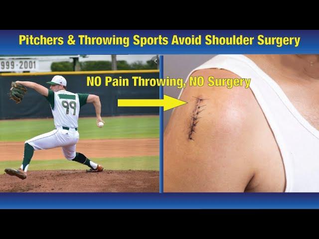 Completely Avoid Shoulder Surgery & Pain Throwing - For Baseball & All Throwing/Hitting Sports