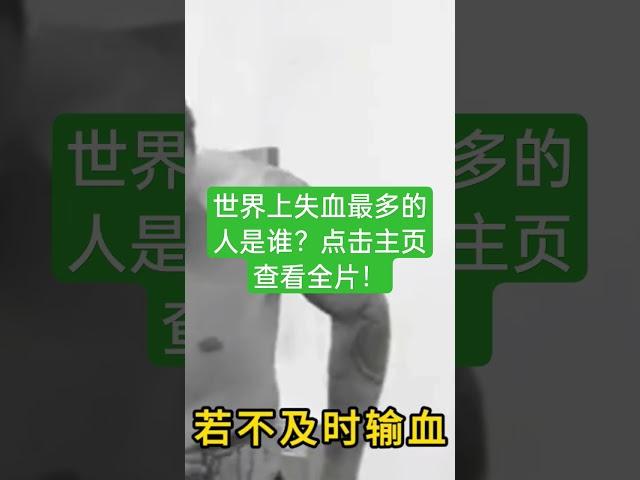 世界失血最多的人是谁？