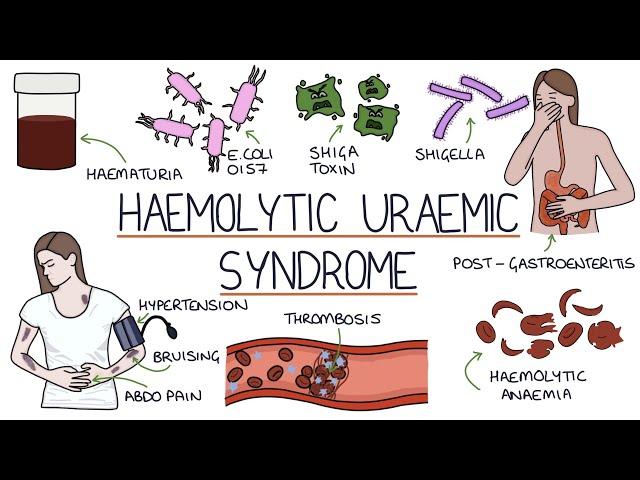 Haemolytic Uraemic Syndrome