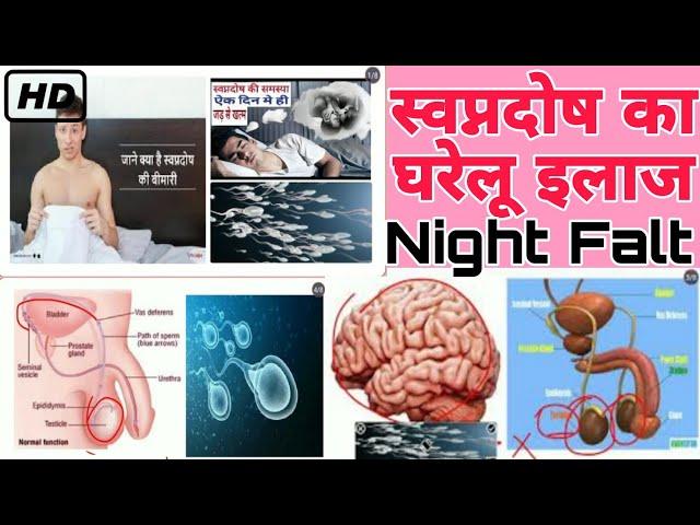 Night Fall Problem Ka Solution।। Night Fall ।। Night Fall Problem ।।स्वप्नदोष ।। @AJ22Classes