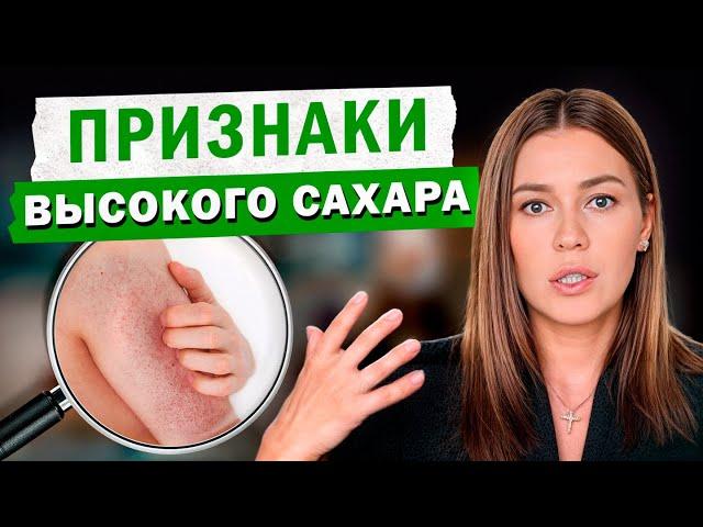 Как быстро распознать повышение САХАРА в КРОВИ? / Признаки повышенной ГЛЮКОЗЫ
