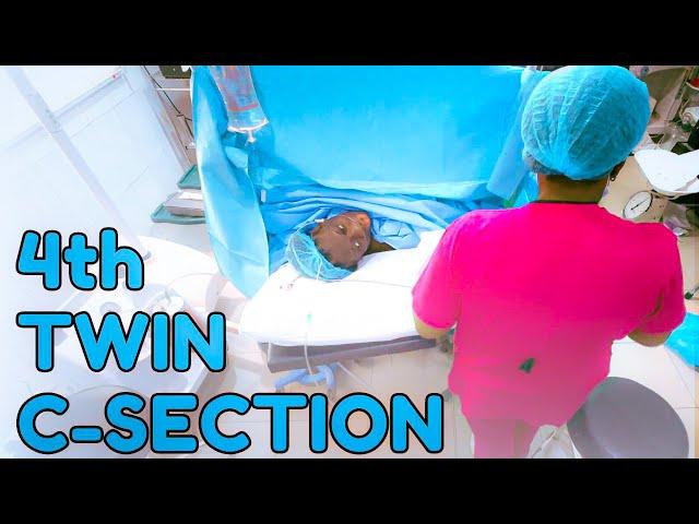 MY 4TH C-SECTION & TWIN BIRTH - SISI YEMMIE