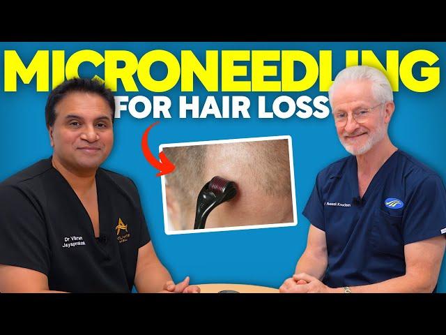 Microneedling for Hair Loss