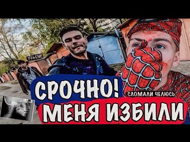 ПЕРЕЛОМ ЧЕЛЮСТИ НОСА БЕСПРЕДЕЛ ИЗ-ЗА ПАРКУРА