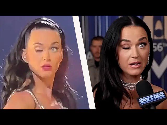 Katy Perry explica problema bizarro no olho durante show