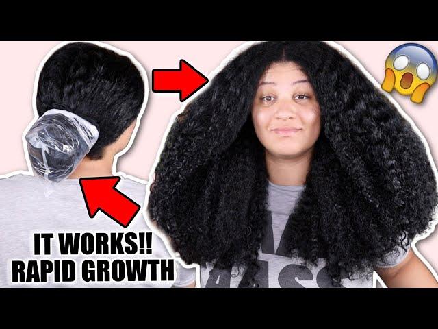 Baggy method for FAST HAIR GROWTH! No more dry ends  Retain length & reduce breakage