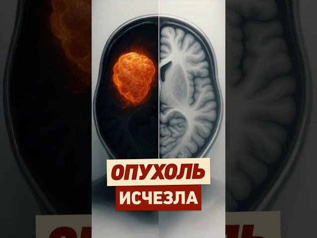 Как ПОБЕДИТЬ РАК без ЛЕЧЕНИЯ? #интересно #факты #наука #медицина #онкология #истории #реддит #апвоут