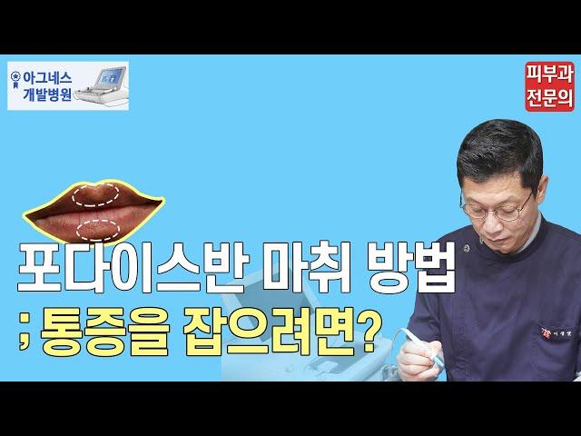 포다이스반점 마취 방법_피부과 제거 통증을 잡으려면?