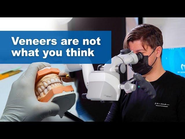 Veneers are not what you think!