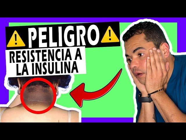 7 SEÑALES   para Identificar [RESISTENCIA a la INSULINA] 