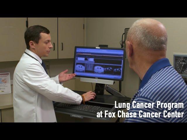 Lung Cancer Program | Fox Chase Cancer Center