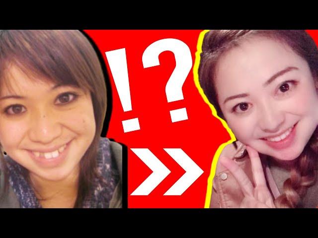 整形級!歯並び最悪女が歯列矯正で顔と人生が激変したお話#2/Aparelho para mudar vida/Japanese crooked teeth