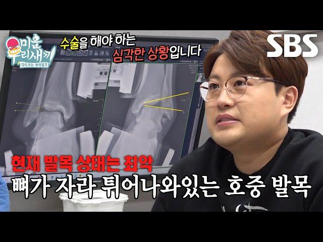“걷지도 못할 만큼..” 김호중, 심상치 않은 발목 상태에 막힌 말문 #미운우리새끼 #MyLittleOldBoy #SBSenter