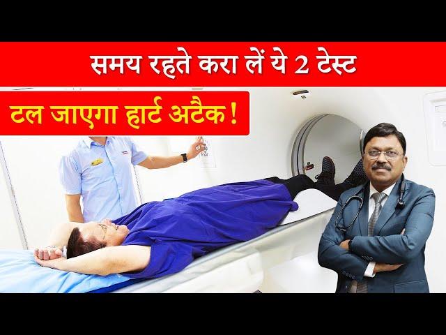 समय रहते करा लें ये 2 टेस्ट, टल जाएगा हार्ट अटैक! | Test for heart disease | Dr. Bimal | SAAOL