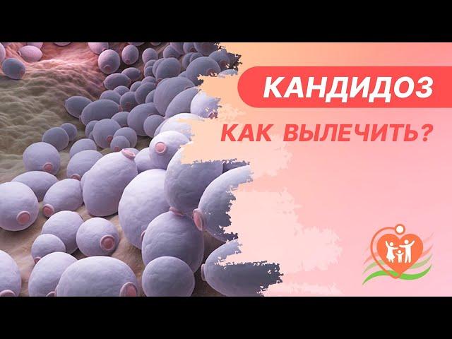   Кандидоз - как вылечить?