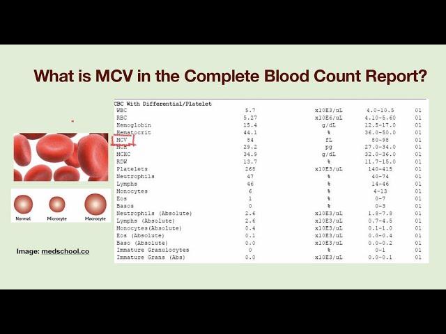 What is MCV? Why my MCV value is abnormal?