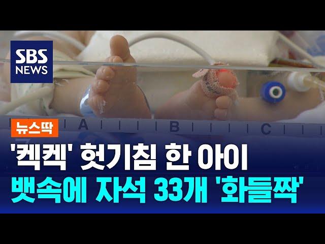 '켁켁' 헛기침 한 아이…뱃속에 자석 33개 '화들짝' / SBS / 뉴스딱