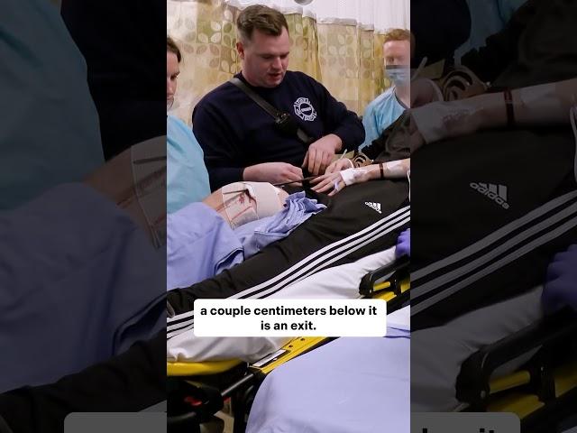 Trauma Resuscitation Demonstration in a Stable Patient with a Minor Perforating Wound #meded #ER #OR