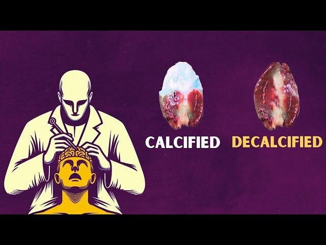 5 Ways to DECALCIFY Your PINEAL GLAND