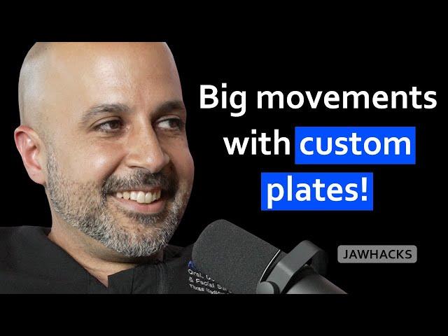 The Power of Custom Plates in Jaw Surgery