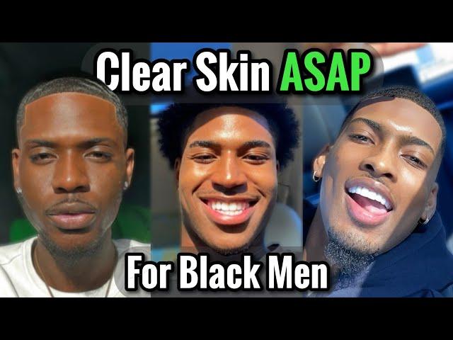 How to Get Clear Skin ASAP for Black Men