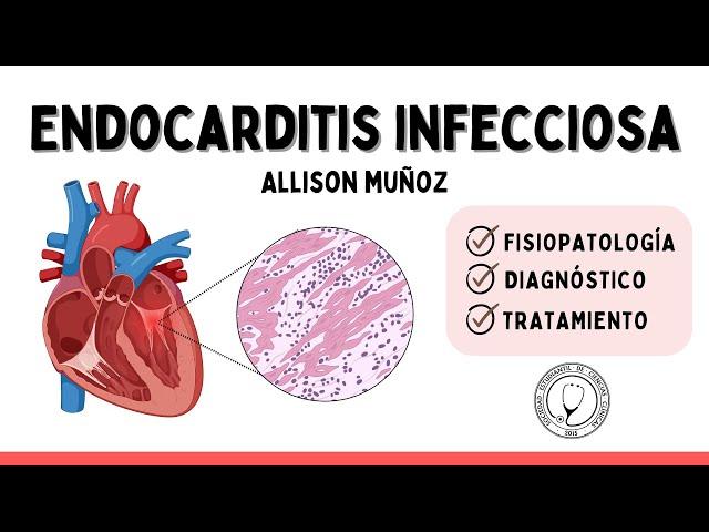 ENDOCARDITIS INFECCIOSA | Cardiología