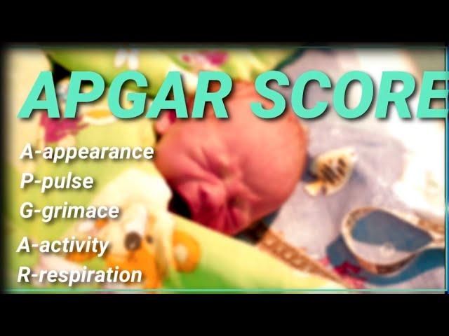 APGAR SCORE//Newborn general health assessment score//बच्चे के जन्म के १ मिनट मे करने वाला स्कोर