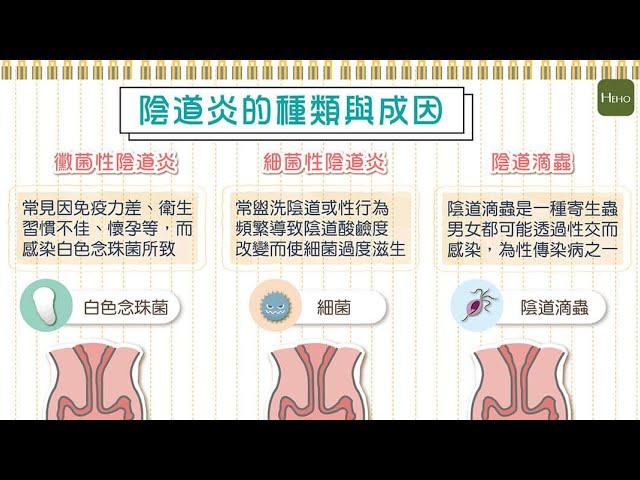 私密處出現搔癢、異味怎麼辦？3 種常見陰道炎種類有這些｜圖解健康動起來